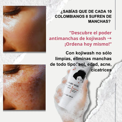 KOJICWASH 2X1: Despigmenta y revive tu piel desde la raiz