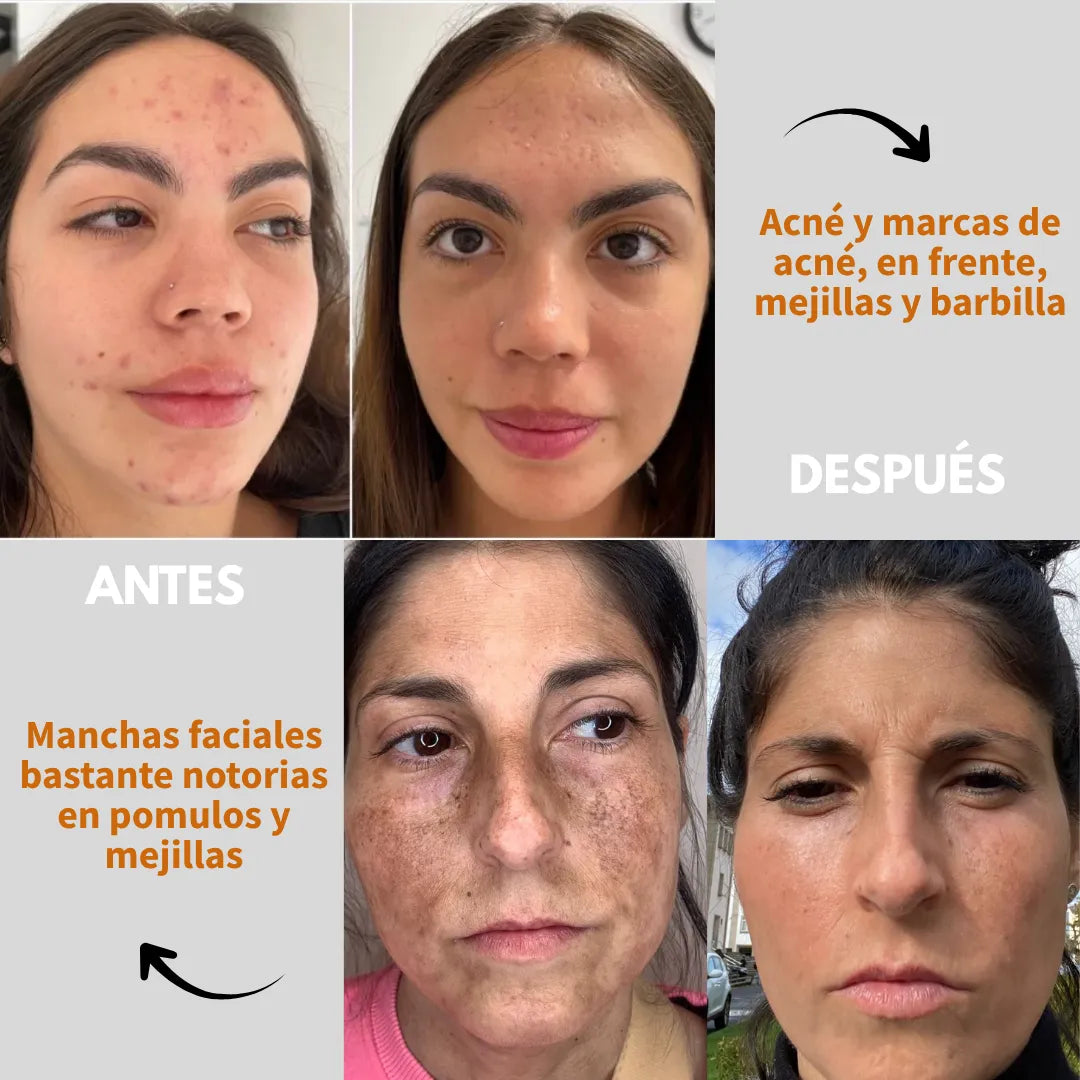RADIANCE C: Repara, Aclara y Rejuvenece + Obsequio